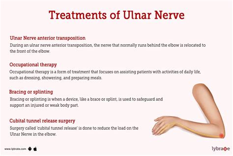 ulnar nerve treatment without surgery